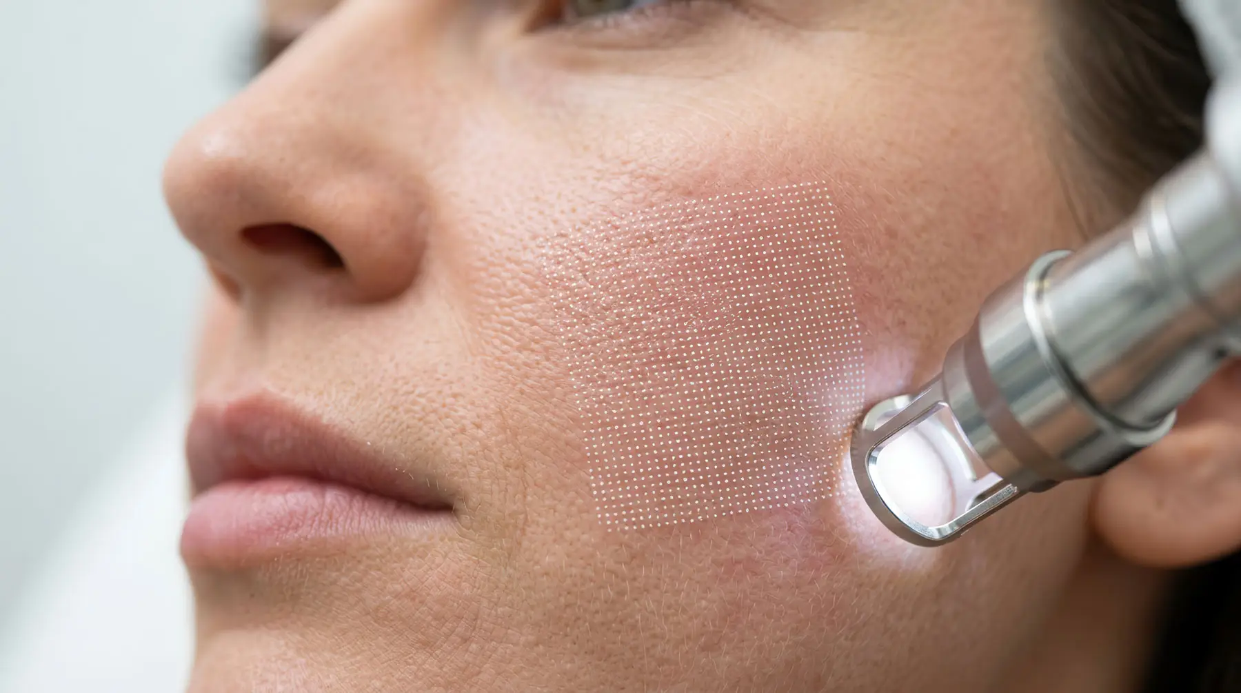 Sage & Honey Wellness Laser Treatments Rancho Mirage, CA