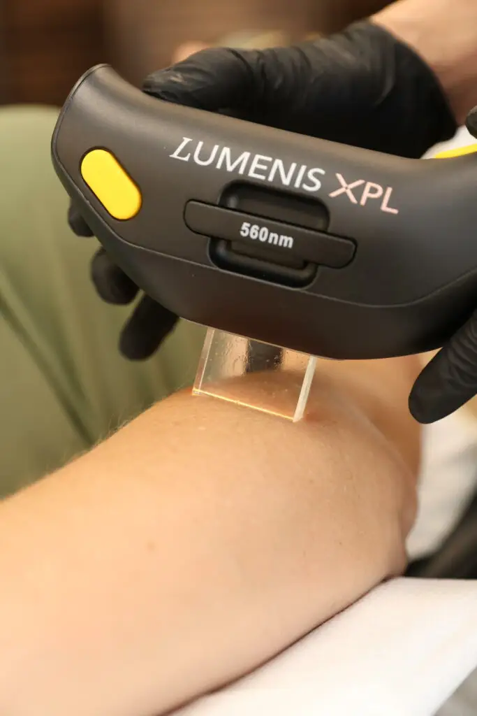 Sage & Honey Wellness IPL Stellar XPL