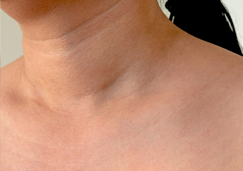 Sage & Honey Wellness Skin Tag Removal